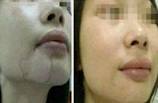 白癜风患者如何做好日常护理